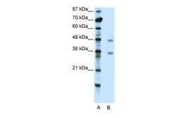 Aviva Systems Biology Corp CBX8 Antibody - C-terminal region (ARP39422_T100)
