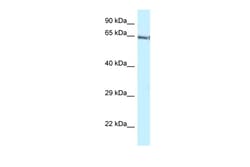 Aviva Systems Biology Corp Gatad2b Antibody - C-terminal region (ARP39430_P050)