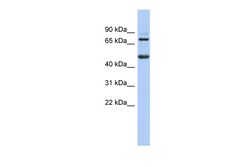 Aviva Systems Biology Corp ZBTB26 Antibody - N-terminal region (ARP39457_P050)