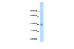 Aviva Systems Biology Corp NR2F2 Antibody - N-terminal region (ARP39465_T100)