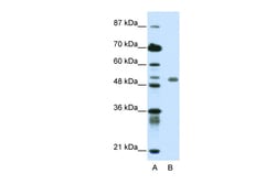 Aviva Systems Biology Corp DEAF1 Antibody - C-terminal region (ARP39468_P050)