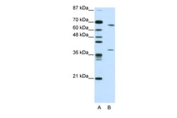 Aviva Systems Biology Corp GRHL3 Antibody - C-terminal region (ARP39489_T100)