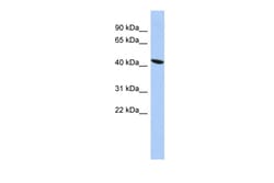 Aviva Systems Biology Corp ZNF71 Antibody - middle region (ARP39498_P050)