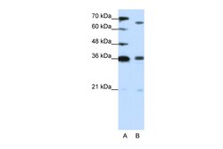 Aviva Systems Biology Corp PRDM13 Antibody - C-terminal region (ARP39506_T100)