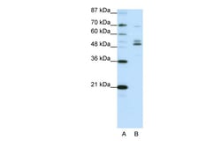 Aviva Systems Biology Corp FOXA2 Antibody - C-terminal region (ARP39509_T100)