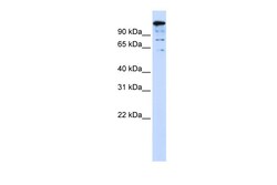 Aviva Systems Biology Corp BACH2 Antibody - middle region (ARP39513_P050)