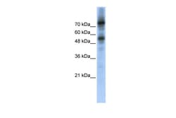 Aviva Systems Biology Corp FOXM1 Antibody - middle region (ARP39519_P050)