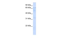 Aviva Systems Biology Corp OPTN Antibody - N-terminal region (ARP39525_P050)