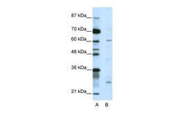Aviva Systems Biology Corp NR1I2 Antibody - C-terminal region (ARP39532_T100)