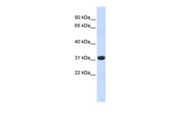 Aviva Systems Biology Corp HOXC8 Antibody - N-terminal region (ARP39557_P050)