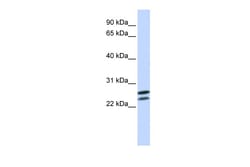 Aviva Systems Biology Corp HOXB4 Antibody - N-terminal region (ARP39581_P050)
