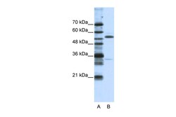 Aviva Systems Biology Corp ZNF655 Antibody - N-terminal region (ARP39587_T100)