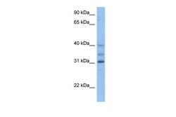 Aviva Systems Biology Corp HOXD1 Antibody - C-terminal region (ARP39596_P050)