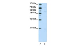 Aviva Systems Biology Corp ZNF329 Antibody - N-terminal region (ARP39603_T100)