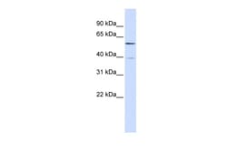 Aviva Systems Biology Corp ZNF419 Antibody - N-terminal region (ARP39606_P050)