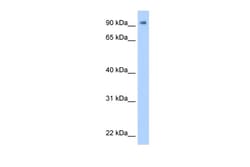 Aviva Systems Biology Corp ZNF408 Antibody - N-terminal region (ARP39616_P050)