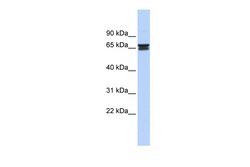 Aviva Systems Biology Corp ZNF614 Antibody - middle region (ARP39641_P050)