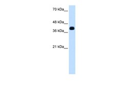 Aviva Systems Biology Corp ZSCAN16 Antibody - N-terminal region (ARP39646_T100)