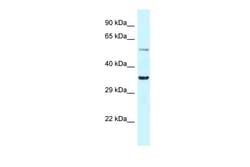 Aviva Systems Biology Corp Bhlhe41 Antibody - N-terminal region (ARP39651_P050)