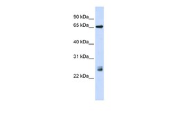 Aviva Systems Biology Corp TRIM8 Antibody - N-terminal region (ARP39655_P050)