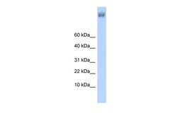Aviva Systems Biology Corp ZNF644 Antibody - middle region (ARP39684_P050)