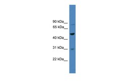Aviva Systems Biology Corp ZNF577 Antibody - C-terminal region (ARP39714_P050)