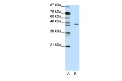 Aviva Systems Biology Corp RIOX2 Antibody - C-terminal region (ARP39722_T100)