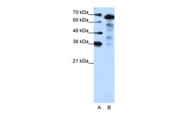 Aviva Systems Biology Corp MLXIPL Antibody - N-terminal region (ARP39736_T100)