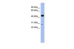 Aviva Systems Biology Corp HSFY1 Antibody - N-terminal region (ARP39745_P050)
