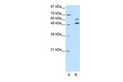 Aviva Systems Biology Corp ZNF682 Antibody - N-terminal region (ARP39750_T100)