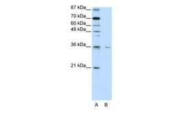 Aviva Systems Biology Corp FOXQ1 Antibody - N-terminal region (ARP39754_T100)