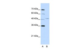 Aviva Systems Biology Corp FOXQ1 Antibody - N-terminal region (ARP39755_T100)