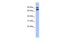 Aviva Systems Biology Corp SOX6 Antibody - middle region (ARP39760_P050)
