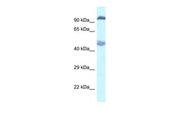 Aviva Systems Biology Corp Egln2 Antibody - C-terminal region (ARP39776_P050)