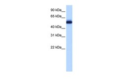 Aviva Systems Biology Corp ZNF545 Antibody - C-terminal region (ARP39800_P050)