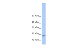 Aviva Systems Biology Corp MAX Antibody - N-terminal region (ARP39844_P050)