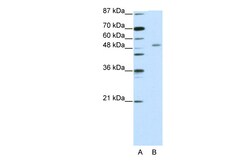 Aviva Systems Biology Corp ZNF498 Antibody - C-terminal region (ARP39846_T100)