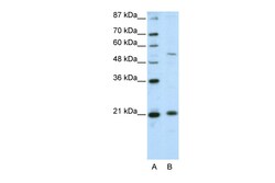 Aviva Systems Biology Corp ZNF31 Antibody - N-terminal region (ARP39855_T100)