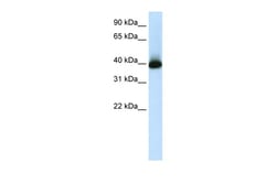 Aviva Systems Biology Corp GSH2 Antibody - C-terminal region (ARP39863_T100)
