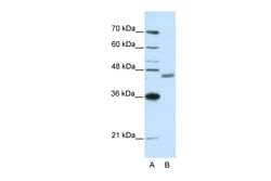Aviva Systems Biology Corp ZNF396 Antibody - N-terminal region (ARP39864_P050)