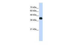 Aviva Systems Biology Corp ISL2 Antibody - N-terminal region (ARP39867_P050)