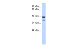Aviva Systems Biology Corp ZNF785 Antibody - N-terminal region (ARP39898_P050)