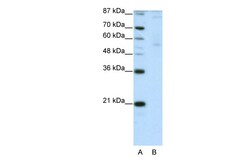 Aviva Systems Biology Corp ZNF92 Antibody - C-terminal region (ARP39923_T100)