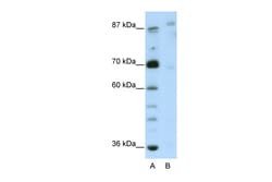 Aviva Systems Biology Corp GLIS3 Antibody - N-terminal region (ARP39924_T100)