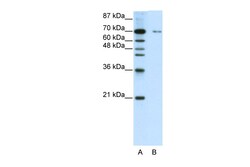 Aviva Systems Biology Corp ZNF398 Antibody - C-terminal region (ARP39969_P050)
