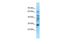Aviva Systems Biology Corp Eya4 Antibody - N-terminal region (ARP39975_P050)