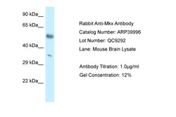 Aviva Systems Biology Corp Mkx Antibody - C-terminal region (ARP39996_P050)