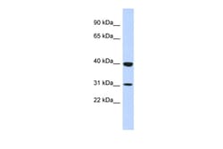 Aviva Systems Biology Corp ZNF660 Antibody - N-terminal region (ARP40000_P050)
