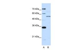 Aviva Systems Biology Corp ZNF707 Antibody - N-terminal region (ARP40004_P050)