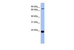 Aviva Systems Biology Corp ZNF800 Antibody - N-terminal region (ARP40017_P050)